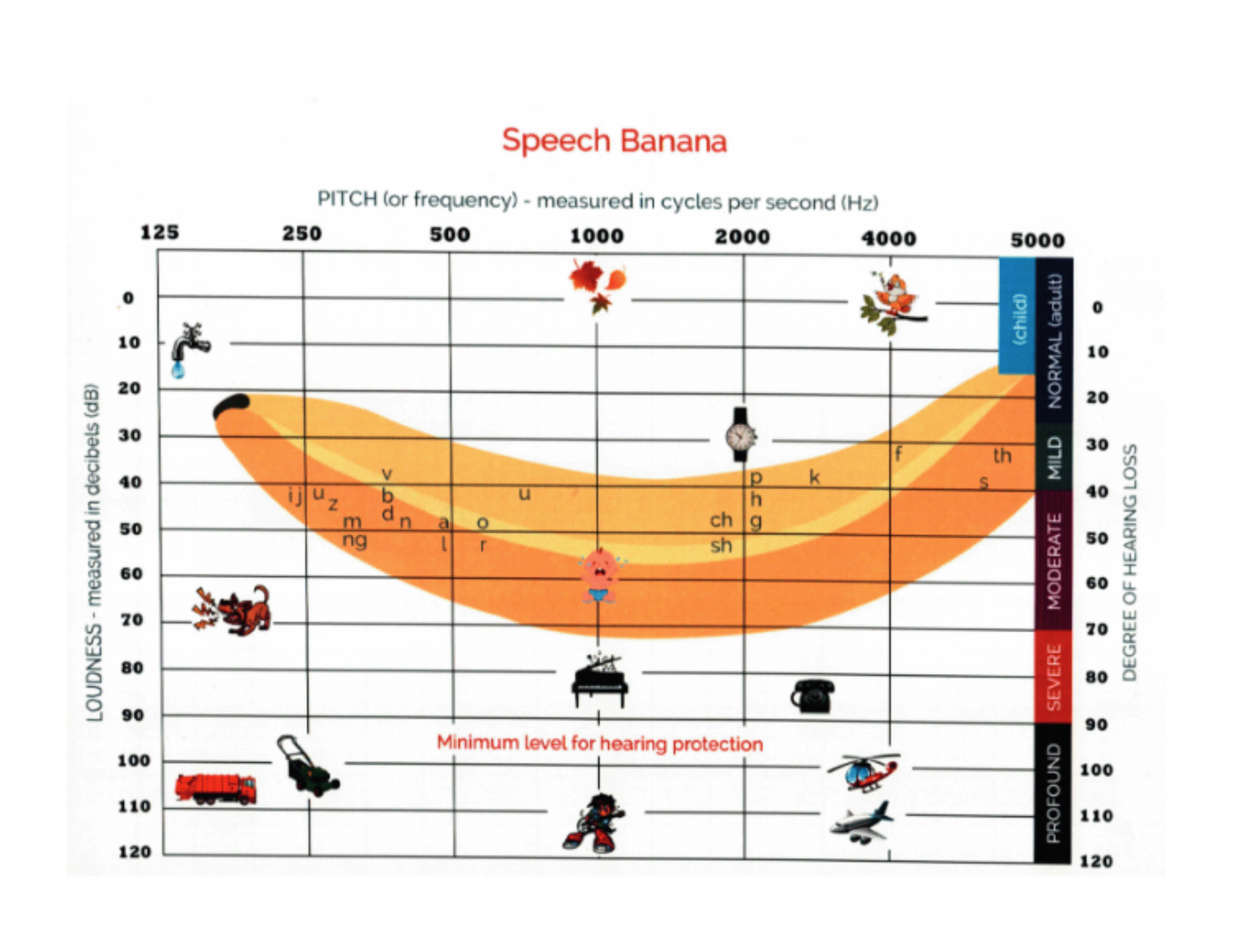 Preview of Speech Banana Hearing Chart